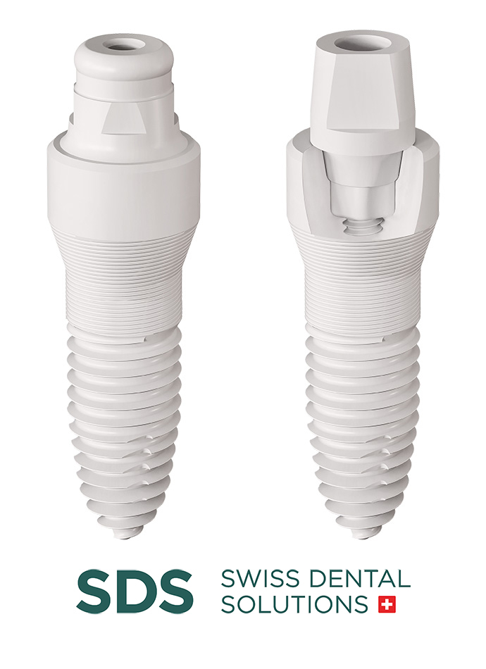 keramikimplantate-swiss-dental-solutions