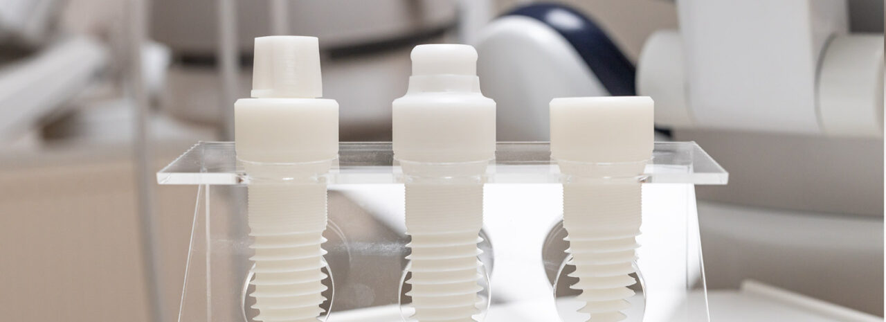 Keramik Implantate - Zahnärzte Brake